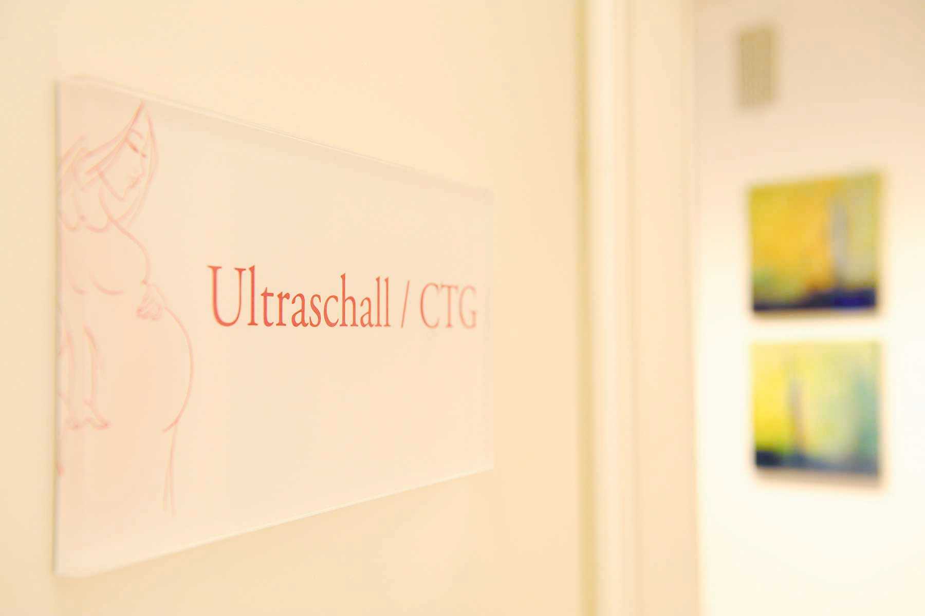 Ultraschall CTG